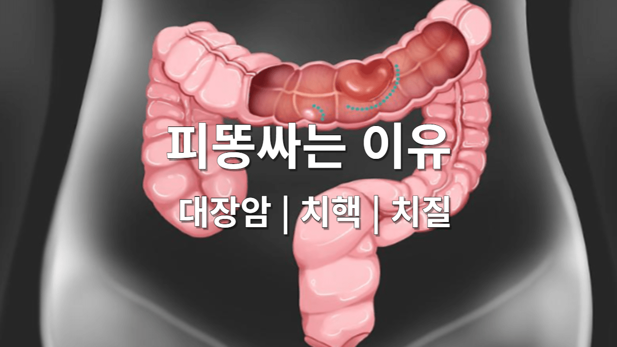 피똥싸는 이유