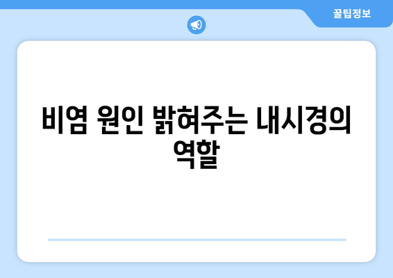 비염 원인 밝혀주는 내시경의 역할