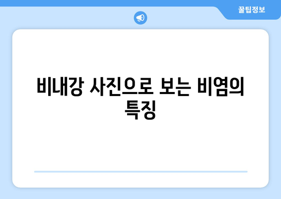 비내강 사진으로 보는 비염의 특징