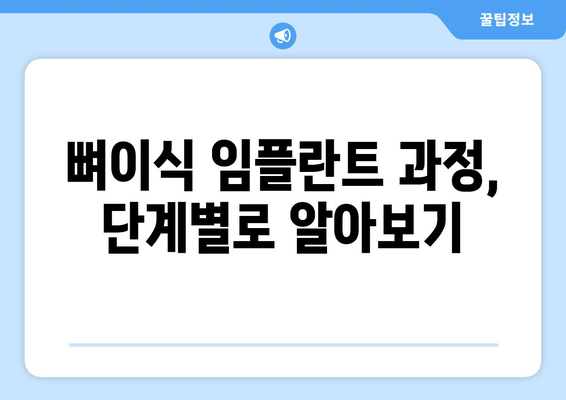 뼈이식 임플란트  가이드| 과정, 치유 기간, 비용  | 성공적인 임플란트를 위한 모든 것