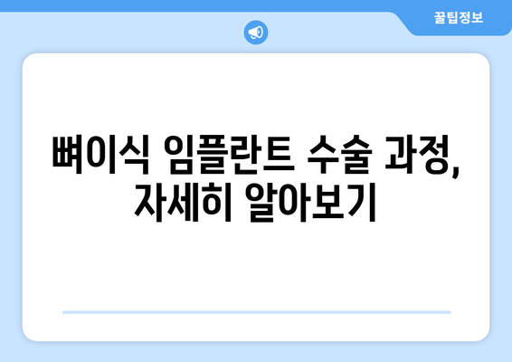 뼈이식 임플란트 수술 완벽 가이드| 과정, 비용, 치유까지 | 임플란트, 뼈이식, 치과