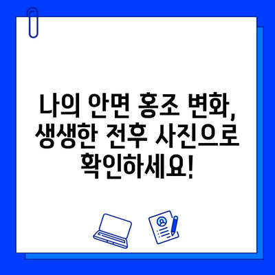 안면 홍조 레이저 후기| 실제 경험담 & 전후 사진 비교 | 안면 홍조, 레이저 시술, 피부 개선, 효과