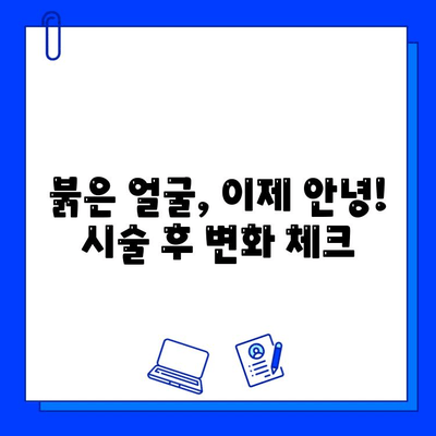 브이빔 레이저 5회 후기| 안면 홍조 개선 효과는? | 안면 홍조, 브이빔 레이저, 피부 개선, 시술 후기