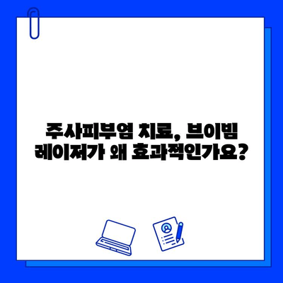 주사피부염 해결, 브이빔 레이저 치료가 답일까요? | 주사피부염, 브이빔, 레이저 치료, 피부과, 효과