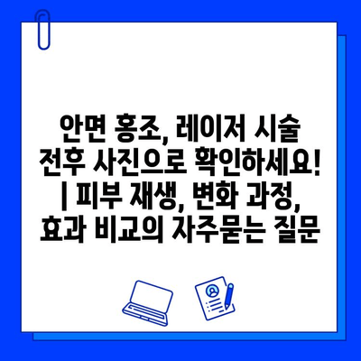 안면 홍조, 레이저 시술 전후 사진으로 확인하세요! | 피부 재생, 변화 과정, 효과 비교