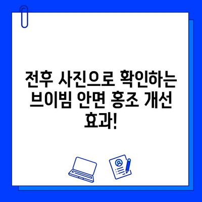 안면 홍조, 브이빔으로 개선했을까? | 전후 사진 리뷰 & 사용 후기