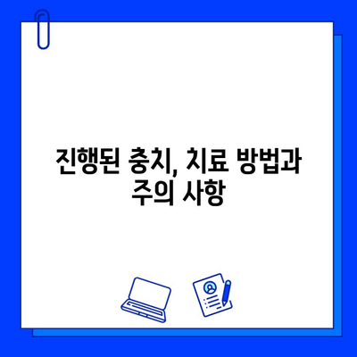 충치 진행 단계별 맞춤 치료 가이드 | 치아 건강, 치과 치료, 예방