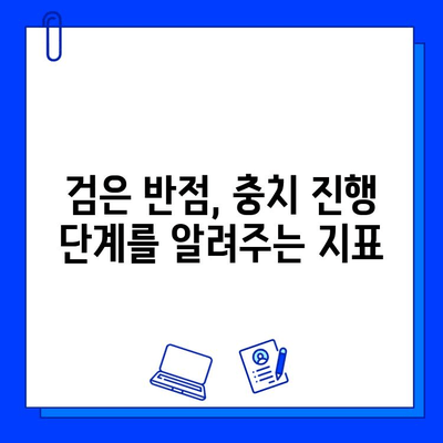 치아에 검은 반점? 충치의 경고 신호일 수 있습니다 | 치아 건강, 검은 반점, 충치 예방, 치과 진료