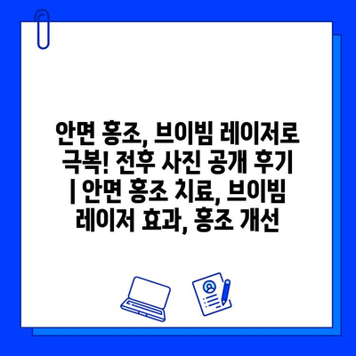 안면 홍조, 브이빔 레이저로 극복! 전후 사진 공개 후기 | 안면 홍조 치료, 브이빔 레이저 효과, 홍조 개선