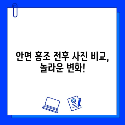 안면 홍조, 브이빔 레이저로 극복! 전후 사진 공개 후기 | 안면 홍조 치료, 브이빔 레이저 효과, 홍조 개선