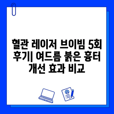 혈관 레이저 브이빔 5회 후기| 여드름 붉은 흉터 개선 효과 비교 | 솔직 후기, 시술 경험, 비용