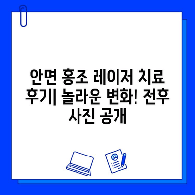 안면 홍조 레이저 치료 후기| 놀라운 변화! 전후 사진 공개 | 안면 홍조, 레이저 치료, 시술 후기, 전후 사진 비교