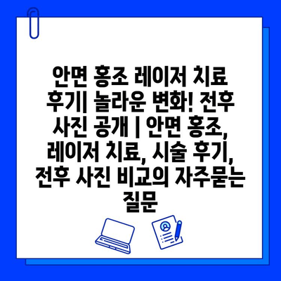 안면 홍조 레이저 치료 후기| 놀라운 변화! 전후 사진 공개 | 안면 홍조, 레이저 치료, 시술 후기, 전후 사진 비교