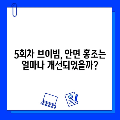 안면 홍조 레이저 브이빔 5회차 후기| 솔직한 변화와 꿀팁 공개 | 안면 홍조, 레이저 치료, 브이빔, 후기, 효과