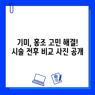 기미, 홍조 개선 효과는? 브이빔 & 큐라스 레이저 후기 | 피부과 시술 후기, 레이저 효과, 기미 홍조 개선