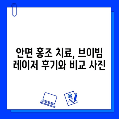 안면 홍조, 브이빔 레이저로 해결 가능할까? | 후기 & 비교 사진, 효과 및 부작용 꼼꼼 분석