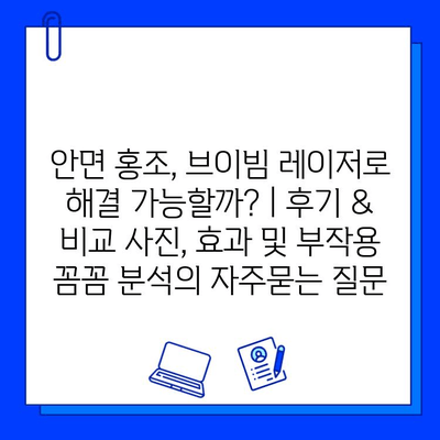 안면 홍조, 브이빔 레이저로 해결 가능할까? | 후기 & 비교 사진, 효과 및 부작용 꼼꼼 분석