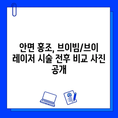 안면 홍조 & 모세혈관 확장, 브이빔/브이 레이저 효과| 개선 전후 비교 및 시술 정보 | 피부과, 레이저 시술, 홍조 치료