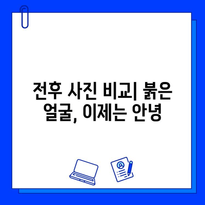 안면 홍조 개선, 브이빔 레이저 효과는? | 전후사진 비교 & 실제 후기 공개