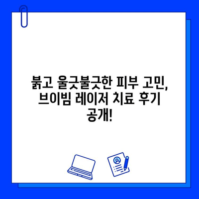 주사성 로사세아 전쟁의 마지막 병기| 브이빔 레이저 치료 후기 | 로사세아, 브이빔, 레이저, 치료, 후기, 효과