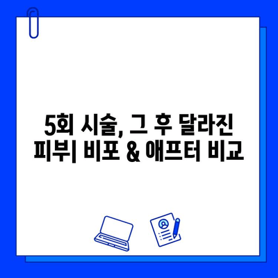 기미 & 홍조 안녕! 브이빔/큐라스 레이저 5회 후기| 효과 & 변화 대공개 | 피부 개선, 레이저 시술, 후기