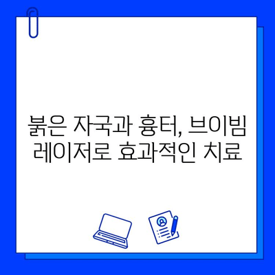 여드름 붉은 흉터, 브이빔 레이저로 효과적으로 개선하기 | 붉은 자국, 흉터 치료, 시술 후기, 비용